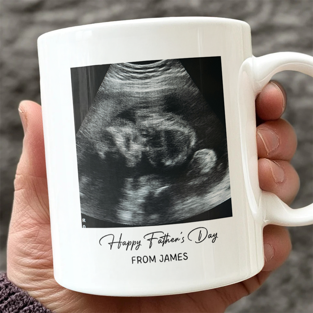 Custom Photo Happy Father's Day Baby Scan Mug - Gift For Father's Day TH10 169933