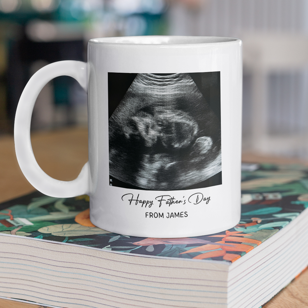 Custom Photo Happy Father's Day Baby Scan Mug - Gift For Father's Day TH10 169933