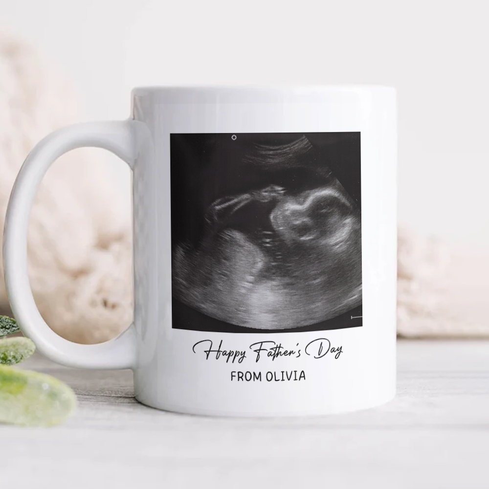 Custom Photo Happy Father's Day Baby Scan Mug - Gift For Father's Day TH10 169933